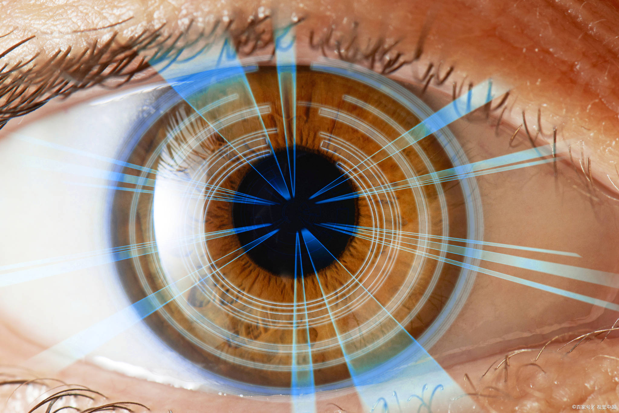 视百年眼科|经常盯着电子屏幕,对于眼睛的损害无疑的