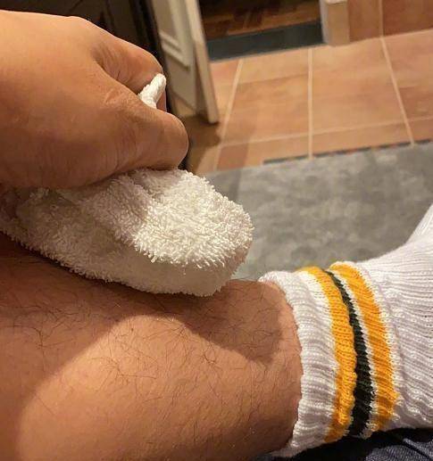 张亮腿受伤肿起大包,晒照却被网友骂"活该",本人这样回应显情商_照片