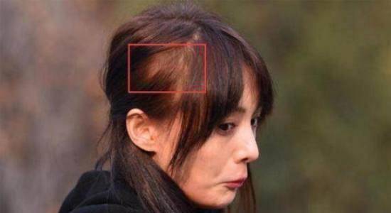 还有angelababy,女孩说呢也难逃一劫啊!