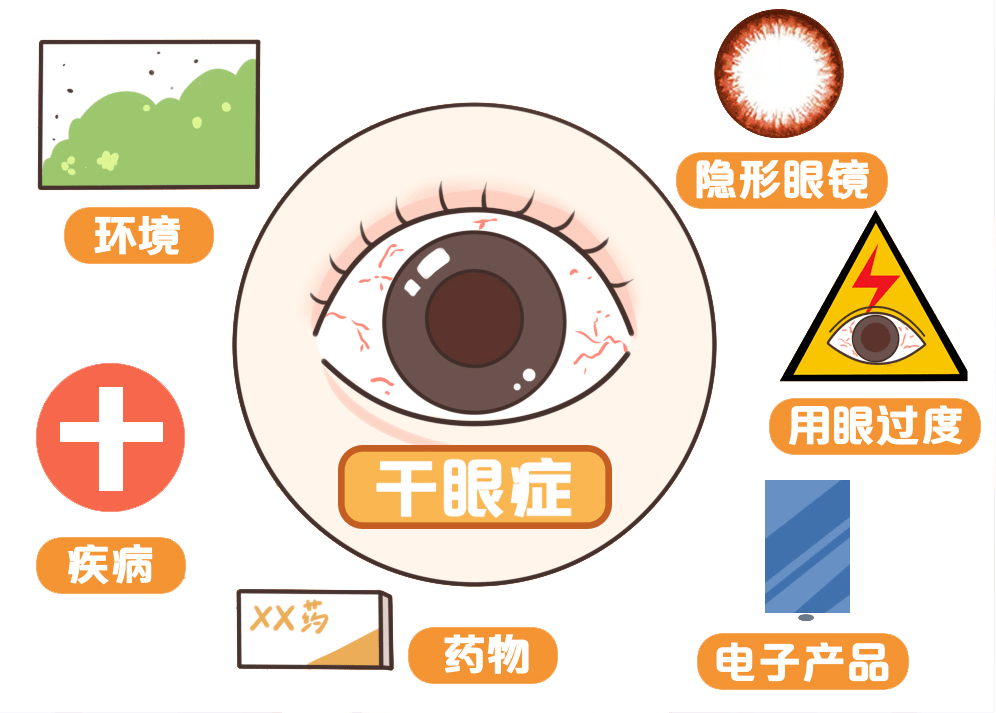 儿童干眼症的原因原越医生提醒家长,当孩子患上干眼症时,他们对眼睛不