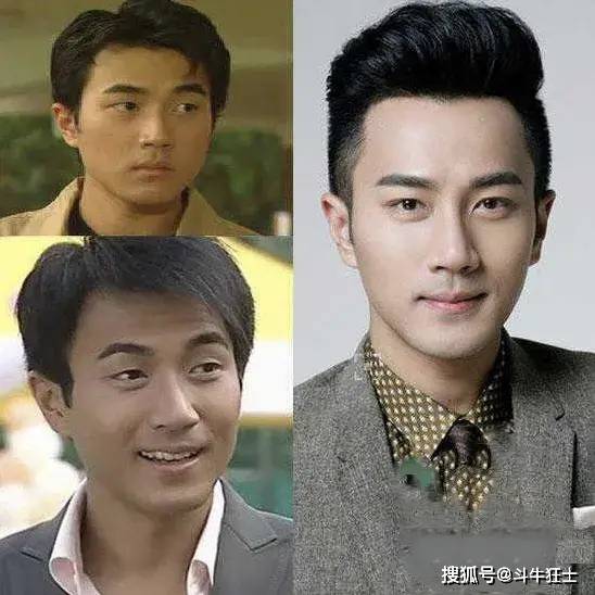 开眼角隆鼻缩鼻翼之后,刘恺威整个人都自信从容了许多.