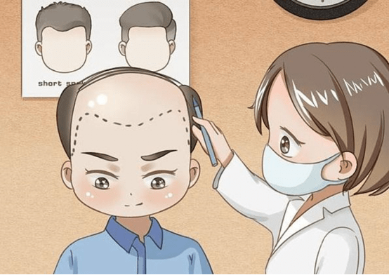 发际线好高怎么改善?科普14大护发秘诀!_头发_效果_品牌