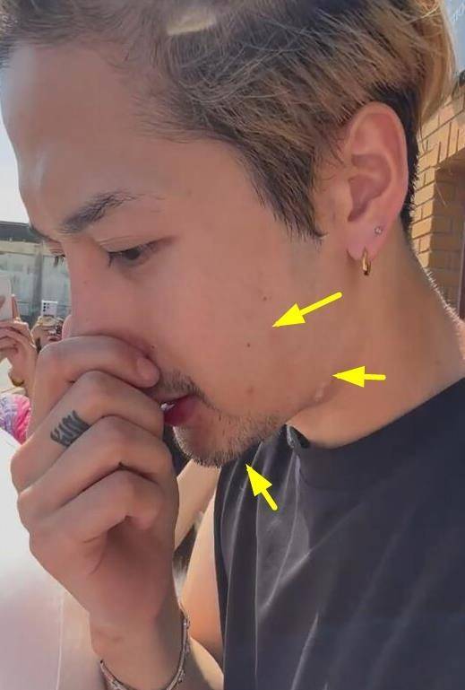 王嘉尔见粉丝捂鼻子引争议,素颜皮肤太差,小腿粗壮胖了20斤!