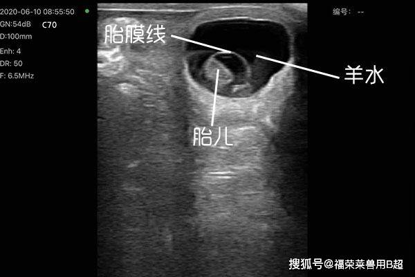 墙裂推荐（怀孕b超恶搞app）怀孕b超恶搞表情包 第6张