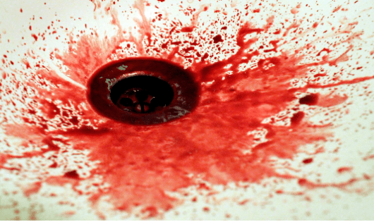 周公解梦,梦见自己身体有好多小吼出血的深层含义与预兆 周公解梦,梦见自己身体有好多小吼出血的深层含义与预兆