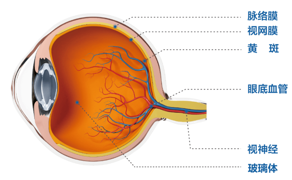 眼底由玻璃体,视网膜,眼底血管,视神经,黄斑区及脉络膜等构成,这些