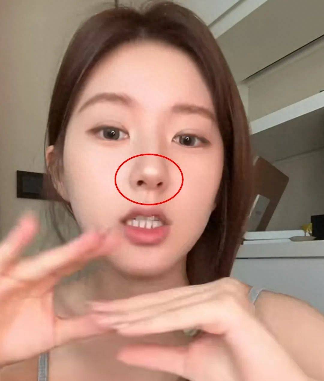 赵露思最新照鼻子还能呼吸吗?像换了个人_圆脸_特色_样子