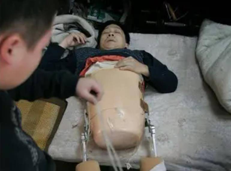 "半截人"彭水林被货车"削"成78厘米,妻子不离不弃,如今当上老板_医生