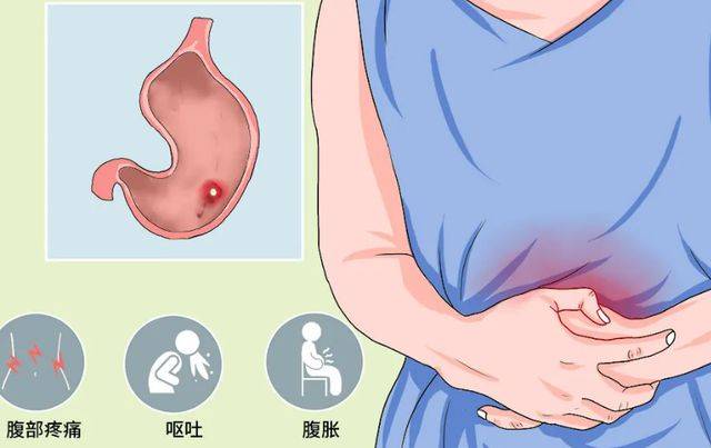 泮托拉唑钠肠溶片护胃:胃病的表现不止疼痛,有些症状更要重视!