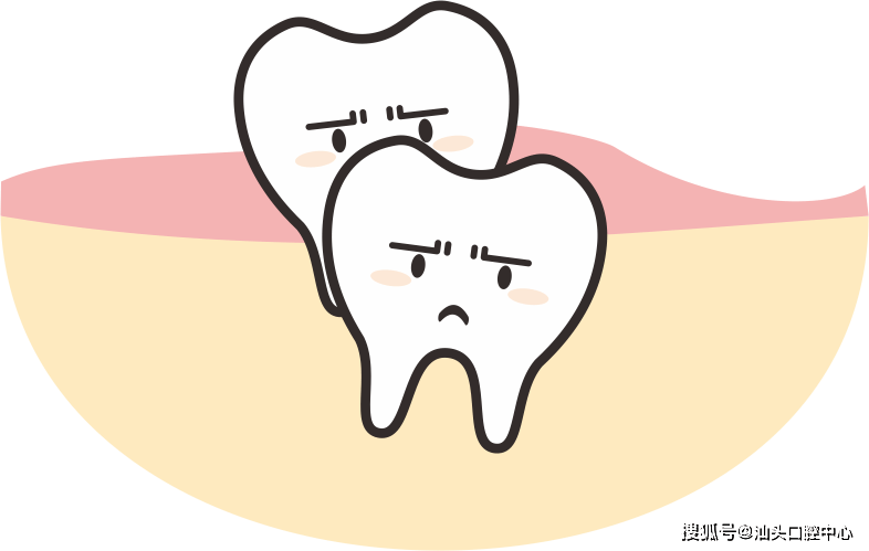 多生牙"潜伏"根尖处或引发牙列不齐,囊肿等,医生妙手拔除_牙齿_后牙