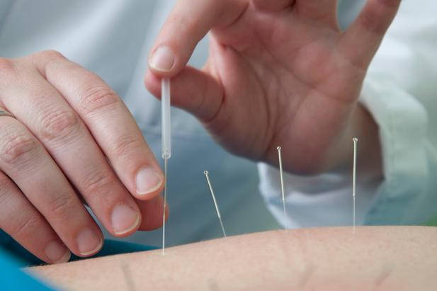 之前了解到,通过针灸刺激穴位可以疏通经络,化瘀散结,从而缓解甲亢