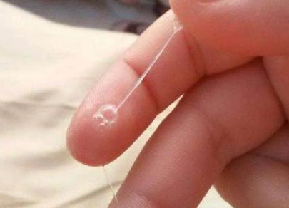 那么也就会导致宫颈粘液增多的情况,阴道分泌相对来说也就会出现增多