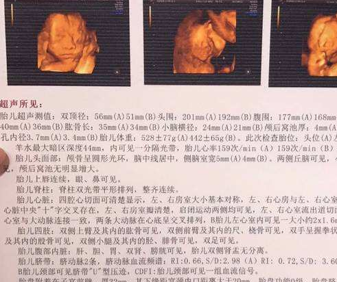 的胎心率来辨别胎儿的性别,一般女宝的胎心率比男宝的胎心率会高一些