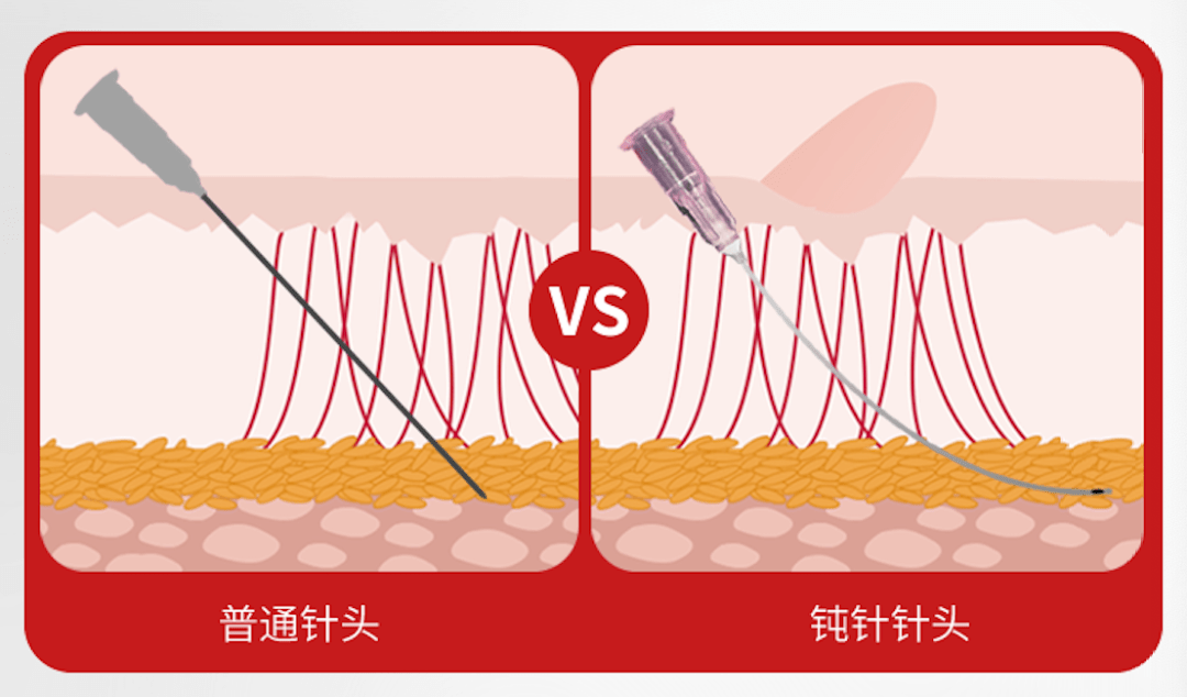 钝针型号对应注射部位图片