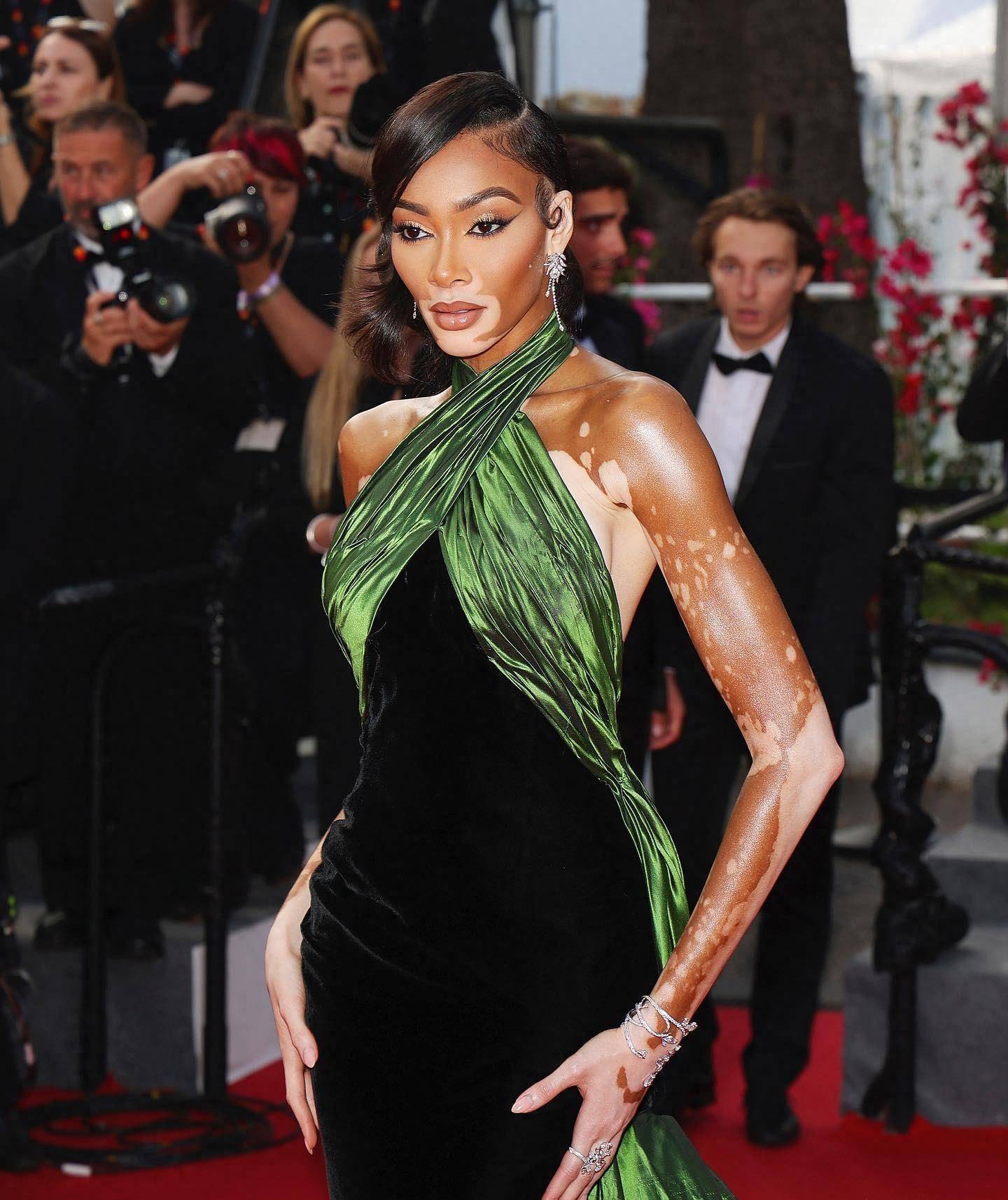 身材绝佳,nba男友最爱她_温妮哈洛_造型_绿色