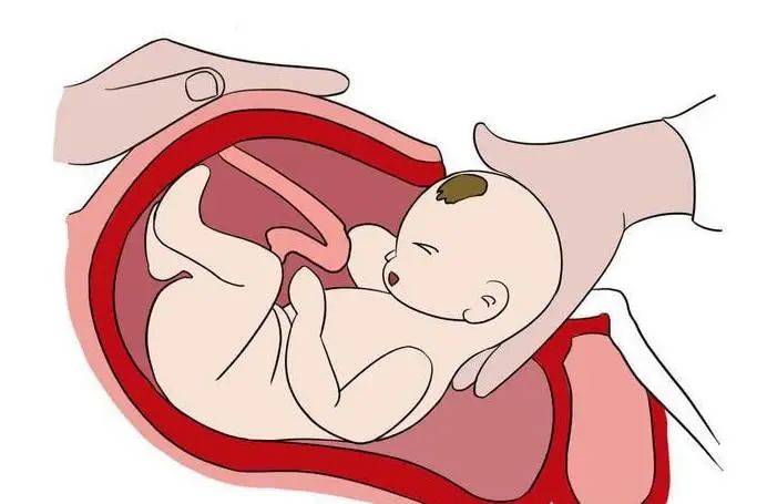 取出胎儿和胎盘后,首先要缝合的第一层是子宫,也就是子宫肌肉层;2.