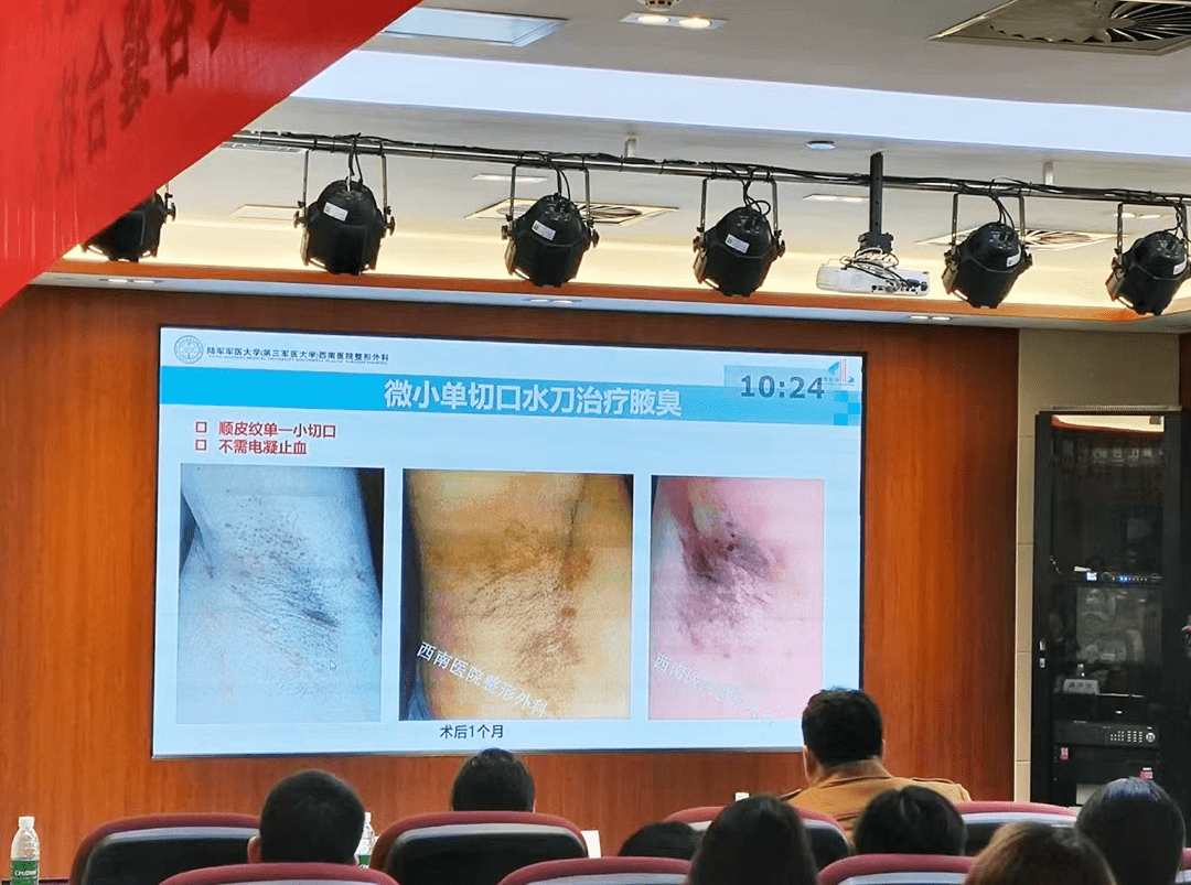 行业专家围绕"微小单切口水刀根治性治疗腋臭"等前沿治疗方案进行分享