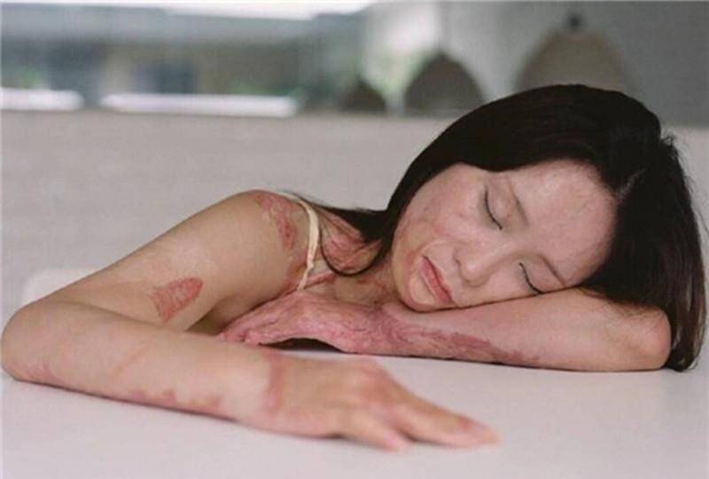 毁容少女周岩:拒绝与官二代交往,遭恶意报复,法院如何判?