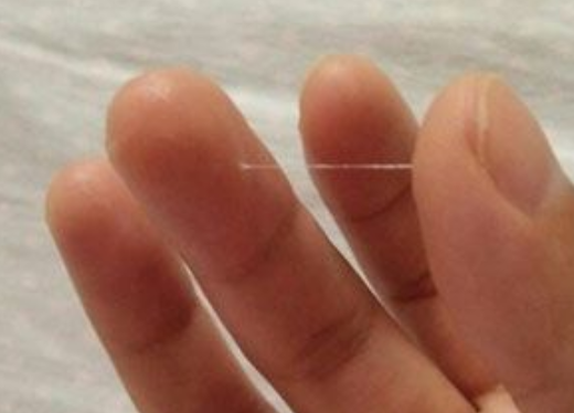 女人"蹲厕所"时,若没有这3种"现象",恭喜,子宫还