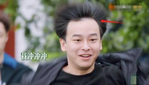 李佳航秃头焦虑引爆网络,何炅,彭昱畅竟也同款高发际线?