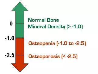 骨質疏鬆是病,3大營養素有助於促進骨骼健康,防止骨質疏鬆_骨密度