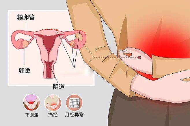 百草益寿:四种表现暗示绝经期到来 绝经后要喝三种水 养护子宫_女性