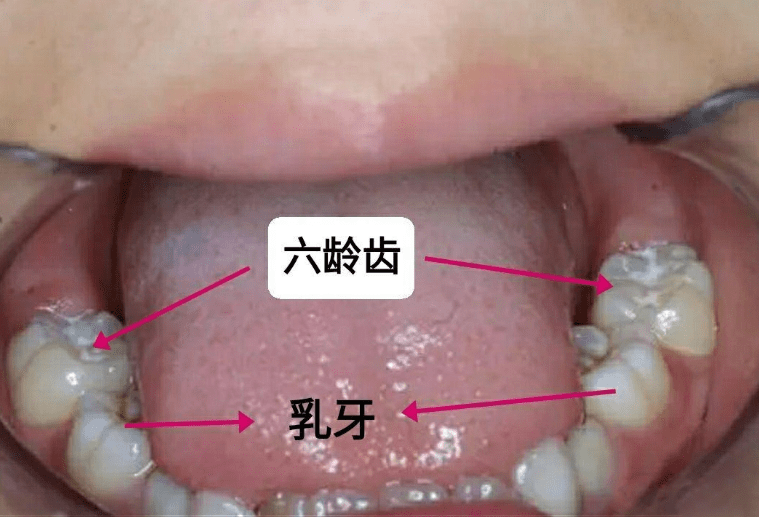 那些牙齿终生不换图片图片