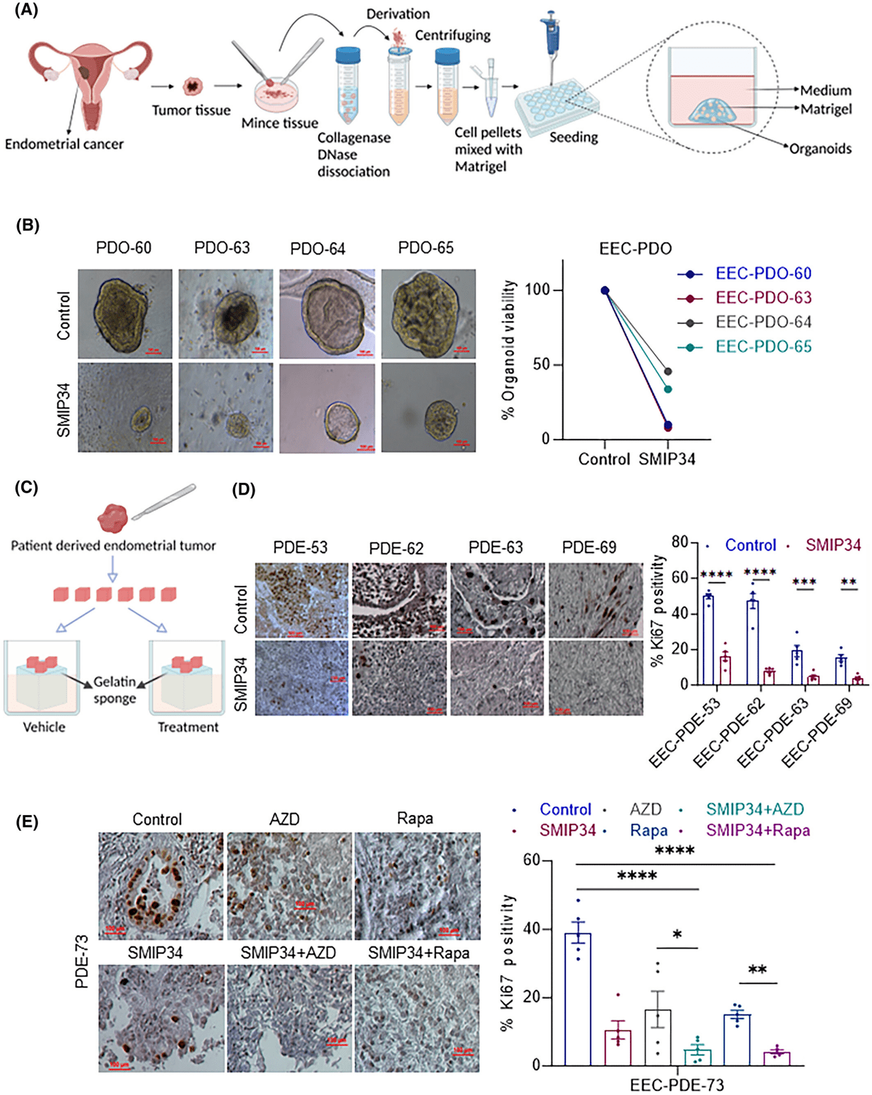 molecular oncology pelp1靶向治疗子宫内膜癌的研究