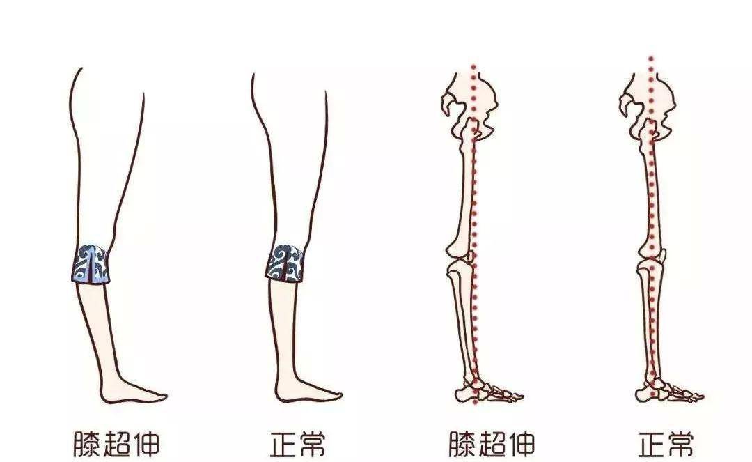 膝关节_大腿_膝盖