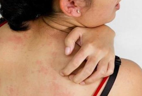 艾滋病病毒"躲藏"在体内,身体可能有4个"表现",早知早预防_人体_时间