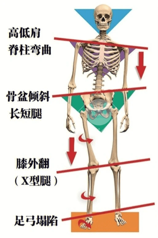 屈髋外展图片