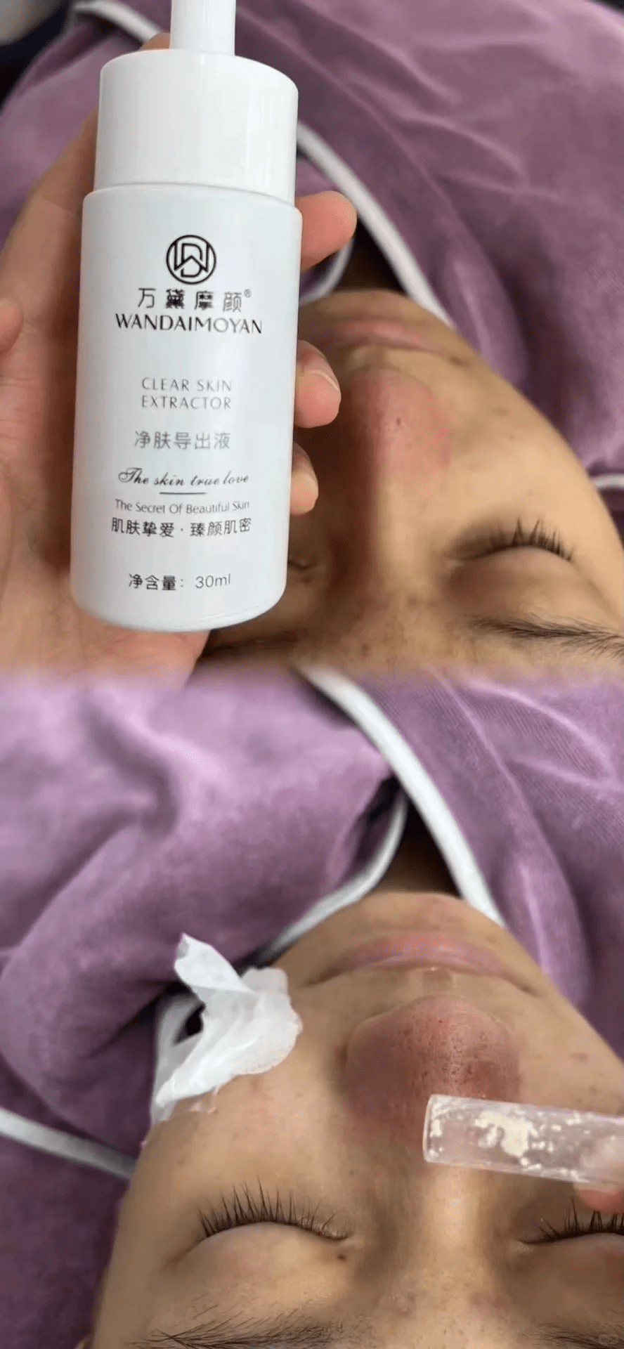 万黛摩颜告诉你:一定要精准清洁护肤!_毛孔_皮肤_因为