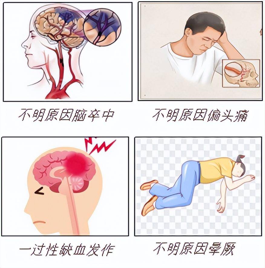 怎麼診斷卵圓孔未閉?