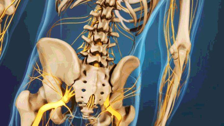 腰椎間盤突出,這些問題,你重視過嗎?_鍛鍊_動作_症狀