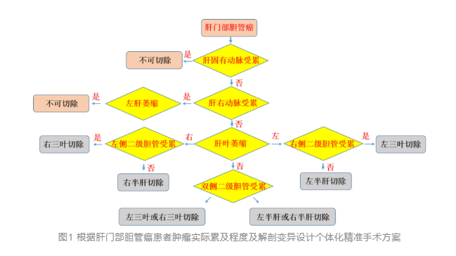 莫名腹脹一個月,竟被確診肝門部膽管癌_手術_患者_進行