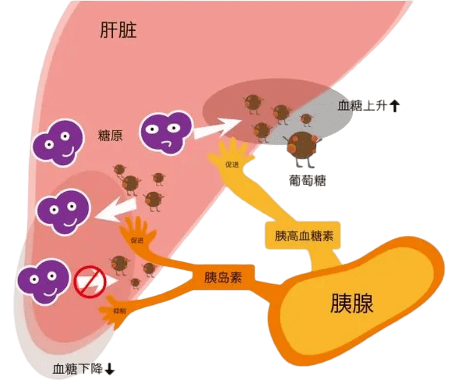 胰岛素抵抗与多囊卵巢图片