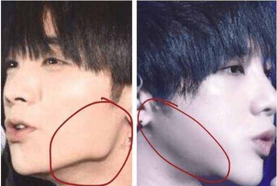 其二就是下颌骨那块地方,华晨宇的侧脸下颌骨咬肌那里较方又有棱角