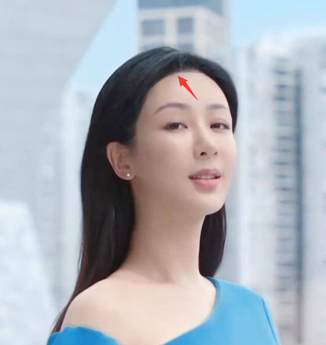 眼睛,鼻子,嘴唇都不自然,就连发际线也像画过一样,没有了曾经的气场.