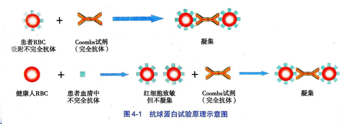 免疫性溶血性貧血(aiha)的診斷和分型診斷,是診斷 aiha 的重要指標,ia