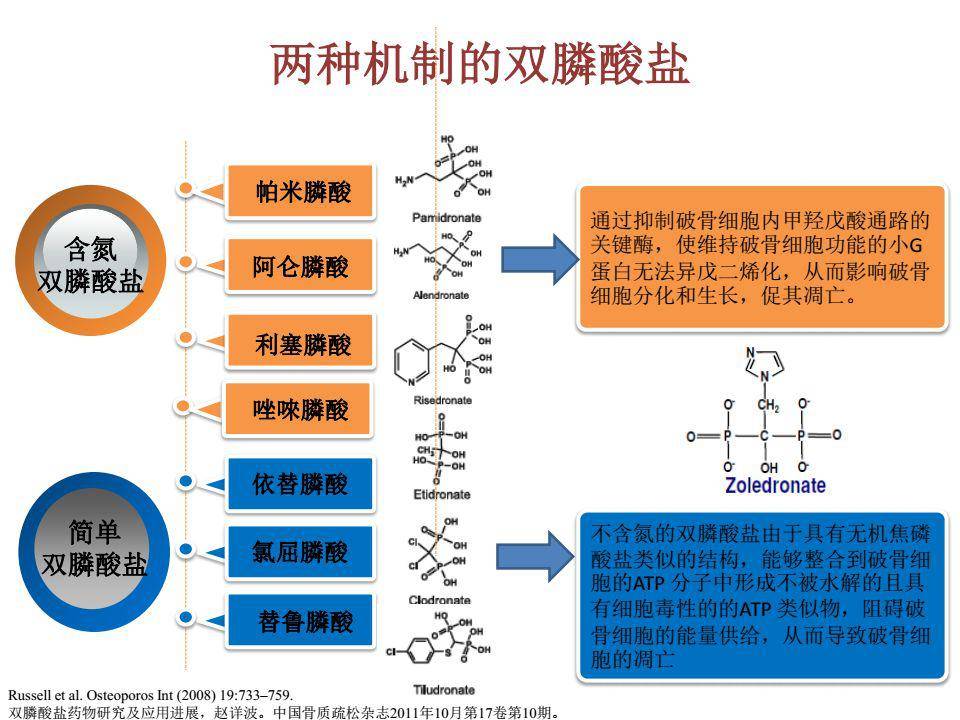 一文搞定paget骨病诊治详解