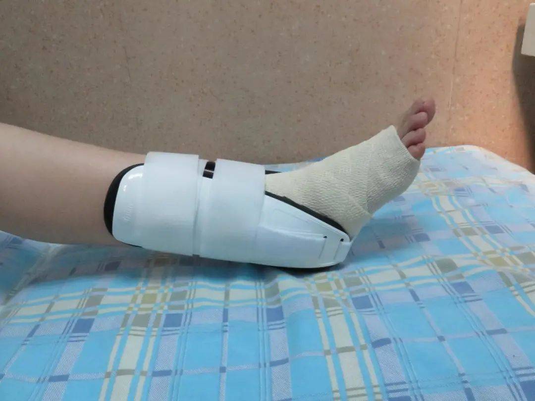 48小时内,尽快用"price"五步法!(内含线上义诊信息)