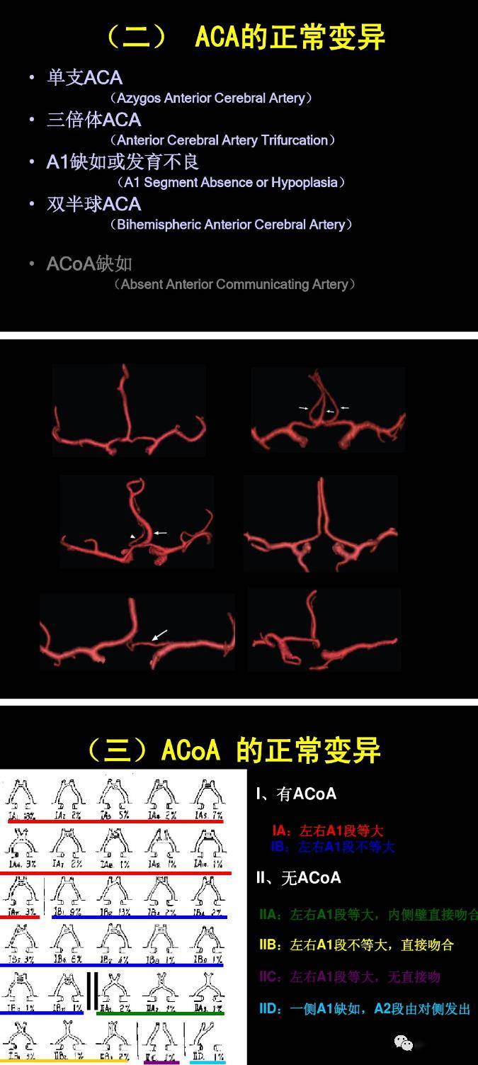 图解脑动脉的正常变异_大脑