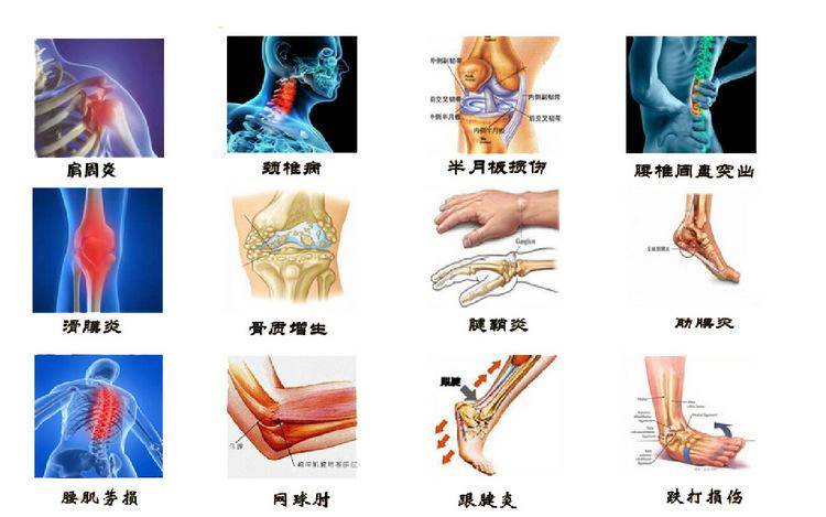 健強手足醫院丨運動對骨質增生有哪些好處