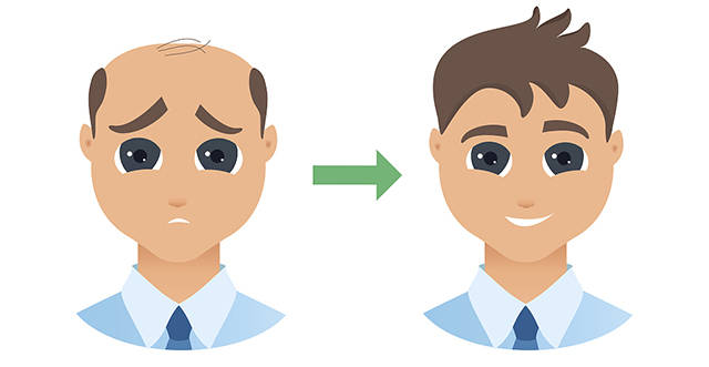 植发,请对自己负责!