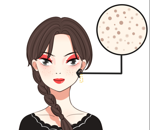 想要远离色斑,这些生活习惯要注意