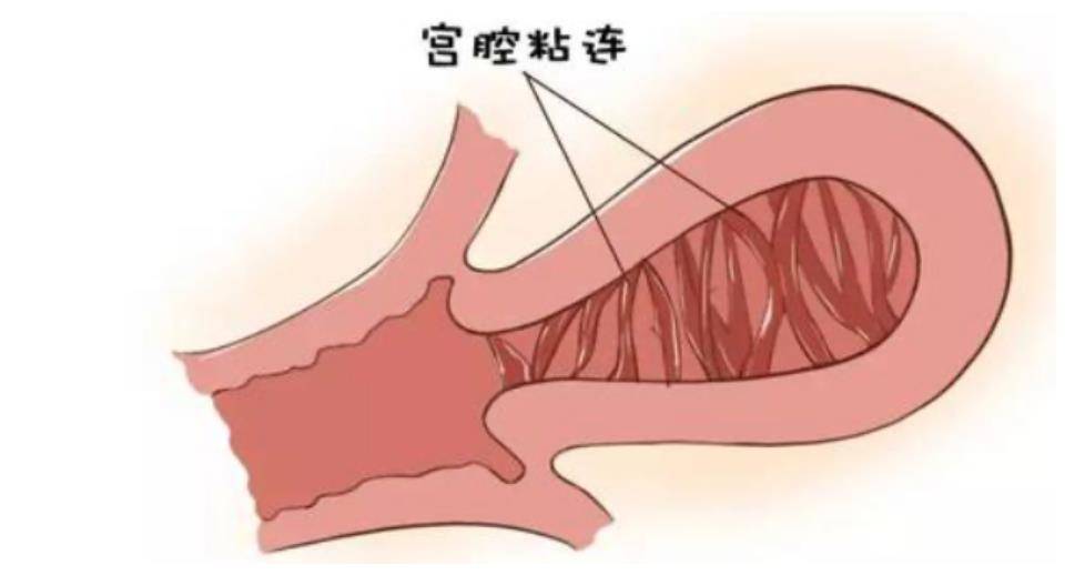 a968ab0256a34004ba90a98f3df95ad3.jpeg