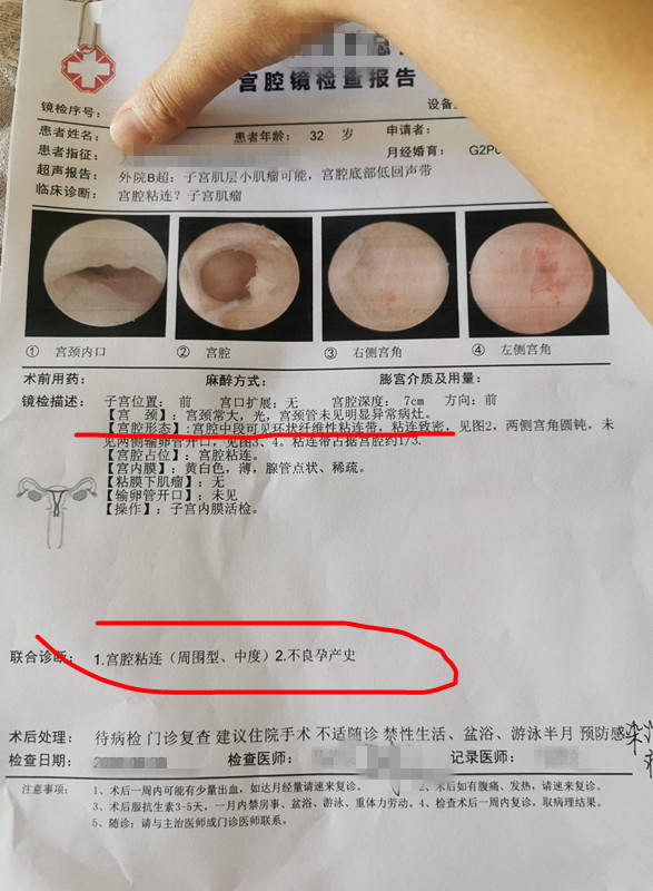 几个月出现胎停 24d6072c1e29425b9ad04e8dd39bbcc4.jpeg