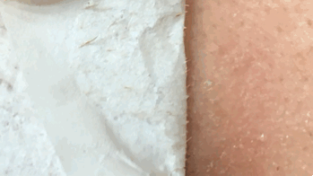 方法|最火的几种去黑头的方法，求求你千万不要再做了！