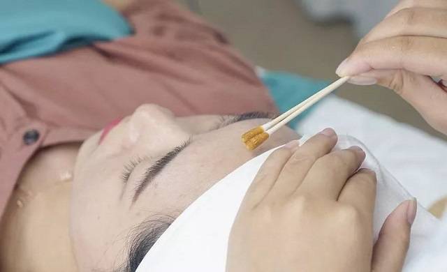 涂药膏喝药祛痘效果快?盘点那些年你用过的祛痘方法