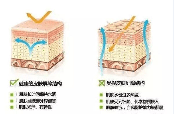 能力|聂亮亮-不要再摧毁你的皮肤屏障，过来看看皮肤屏障怎么修复